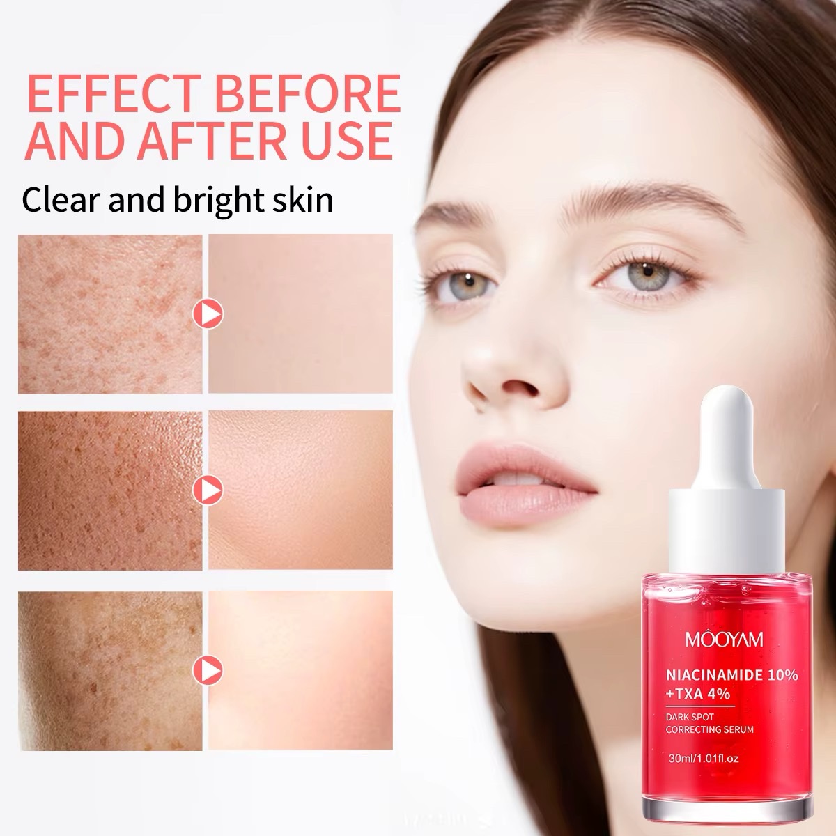 MÔOYAM Niacinamide 10% + TXA 4% Dark Spot Correcting Serum — 30ml - Image 4